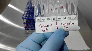 39K views · 400 reactions | Procedimiento Coombs directo, poliespecífico y monoespecífico en tarjeta. | UPS LAB | Facebook