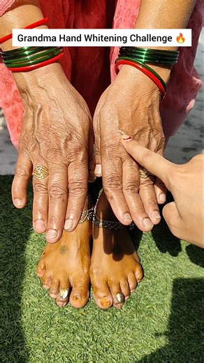 Remove Hand Tanning | Hand Cleaning Tips | #handwhitening #shorts