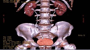 Video Stok Ct Scan Urinary System Ct Urography (100% Tanpa Royalti) 1019951629 | Shutterstock