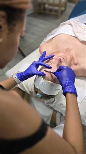 DermaplanePro on Instagram: "Real technique. Real results. ✨ Step into the treatment room with one of our expert trainers and watch dermaplaning done with intention. From pressure to precision, every move is purposeful—and rooted in client safety, comfort, and results. Video via @kandra_charlestonmedicalspa #DermaplanePro #DermaplaningEducation #ExpertInAction #EstheticianTraining #SkincareProfessionals #DermaplaningTechnique"