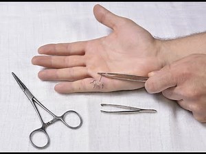 Cpt code for Removal of foreign body in muscle - simplify medical coding