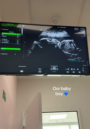 Our Baby Boy at 27 Weeks: A Joyful Scan Experience
