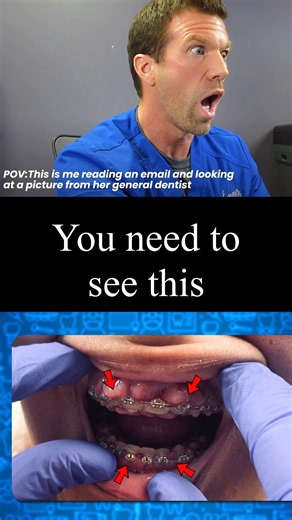 You Need to See This (More Braces Transformations Coming)