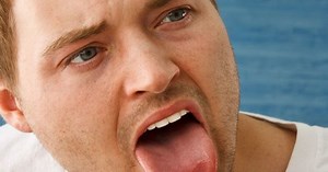 How to spot mouth cancer