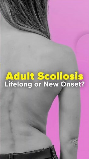 Adult Scoliosis vs Degenerative Scoliosis Why It Happens Later in Life | Dr Deeptee Jain