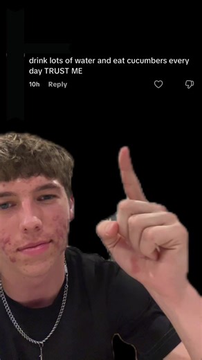 How to Get Rid of Acne: Effective Prevention Tips