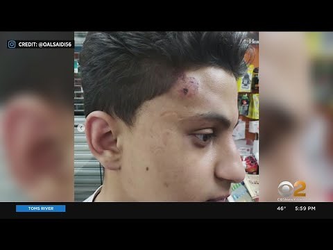 Paterson Police Officers Accused Of Assaulting 19-Year-Old