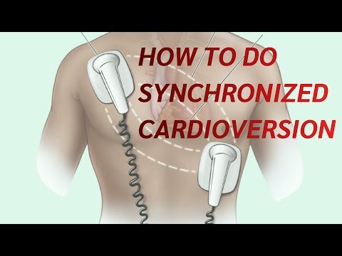 สาธิตวิธีการ Synchronized cardioversion เครื่อง Defibrillator ยี่ห้อ ZOLL รุ่น R series