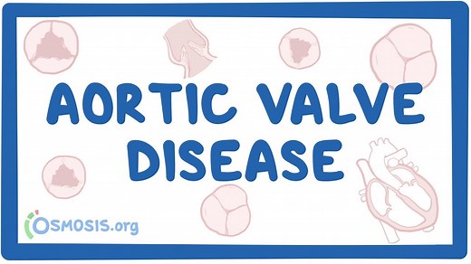 Aortic valve disease: Video, Causes, & Meaning | Osmosis