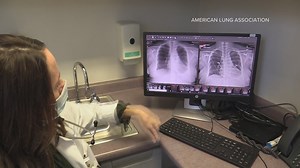 Here's how young adults can get paid by participating in the American Lung Association's 5-year study