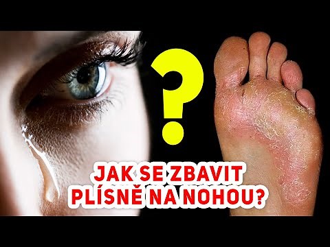 MYKÓZA, PLÍSEŇ NOHOU A NEHTŮ. JAK SE ZBAVIT JEDNOU PROVŽDY
