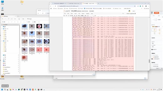 基于CT图像肠道自动分割深度学习模型构建