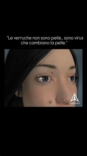 Biolab_divulga on Instagram: "Le verruche non sono semplici ispessimenti della pelle: sono lesioni benigne causate dall’infezione da papillomavirus umano (HPV), un virus estremamente diffuso che modifica il comportamento delle cellule dell’epidermide. Quando l’HPV entra attraverso micro-abrasioni, raggiunge lo strato basale della pelle e riproduce il proprio DNA dentro i cheratinociti, alterandone il ciclo cellulare. 🔍 Cosa accade a livello cellulare - L’HPV infetta i cheratinociti basali, le c