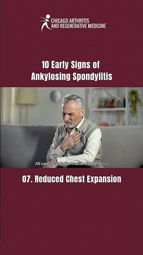 PART 7 | 10 Early Signs of Ankylosing Spondylitis You Shouldn’t Ignore!