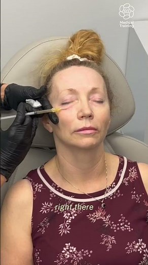 Mastering Under eye PRP injections #r3medicaltraining#prpinjectjon #aesthetics