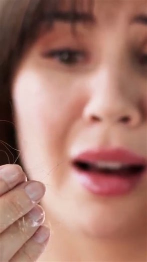 Why Is My Hair Falling Out So Much? #shorts