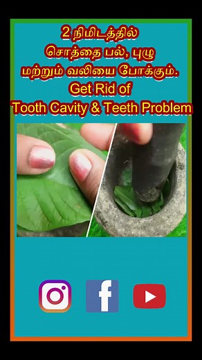 1.1M views · 8.9K reactions | 2 நிமிடத்தில் சொத்தை பல் புழு மற்றும் வலியை போக்கும் | Get Rid of Tooth Cavity | Teeth Problem | Tamil Health and Beauty | Facebook