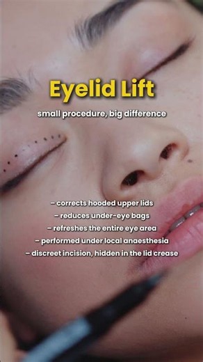 Eyelid Lift Surgery
