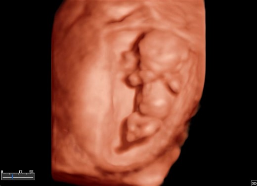 3G Diagnostic Imaging Center -3G DIC on Reels