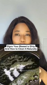 30K views · 437 reactions | S!gns Your Bløøød is D!rty And How to CIęan It NaturaIIy | Your Guide 2 Healthy Living | Facebook