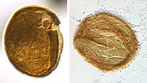 200-Million-Year-Old “Problematic” Microfossils Finally Identified, And They’re Super Weird