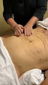 Post Lipo MLD/Manual Lymphatic Drainage