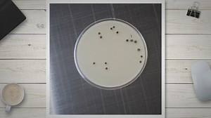 Sterile Assurance Level (SAL) vs. Log Reduction