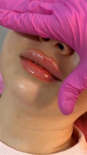 Iglamour Cabinet on Instagram: "#lipsfillers #glamour #tanger"