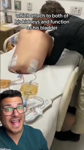 Half of his body amputated - hemicorporectomy