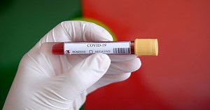 DGS muda estratégia. Alargamento da testagem, rastreios e mais testes rápidos para a covid-19