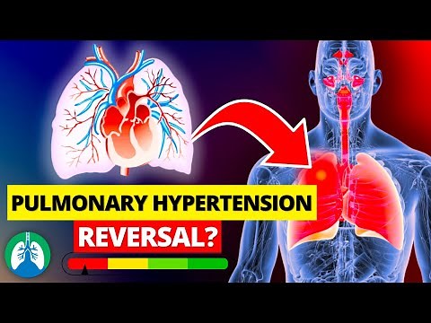Do THIS to Reverse Pulmonary Hypertension with Natural Methods