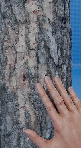 The body tries to remove the splinter itself #body #tries #remove #splinter #itself | Universal SID