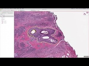 QuPath for H&E