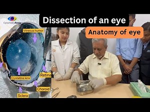 Eye dissection || Learn anatomy on real eye || Optometryreels