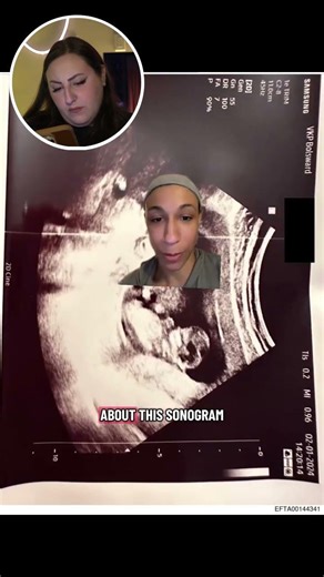 A 2024 Sonogram in the Epstein Files?