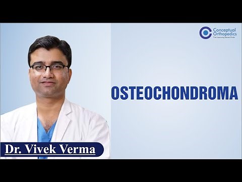 Osteochondroma by Dr. Vivek Verma @Conceptual Orthopedics