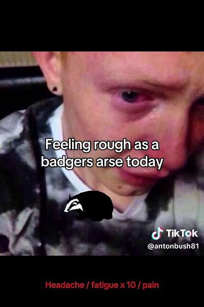 Experiencing 1st Amgevita Side Effects on Day 5