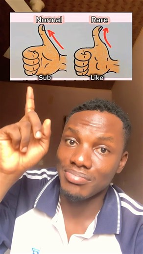 I’m normal..😁 #remix #duet #phonkagressive