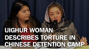 148K views · 1.4K reactions | "Each time I was electrocuted my body...