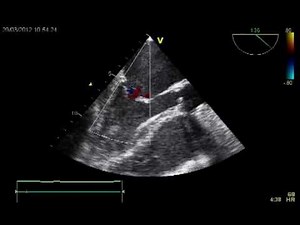CARDIAC ARREST CARDIOPULMONARY RESUSCITATION