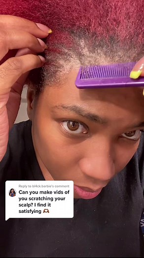 Dealing with Scalp Psoriasis and Dandruff Flare-ups