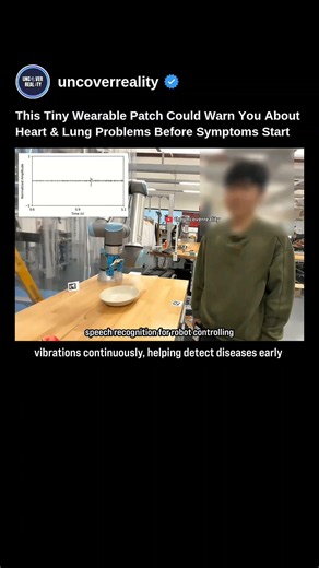 This Wearable Patch Technology C Warn You About Heart & Lung Problems Before Symptoms Start #shorts