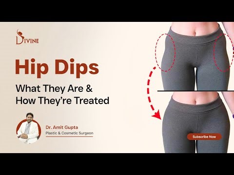 Hip Dip Correction Explained | Causes, Treatment & Surgical Results