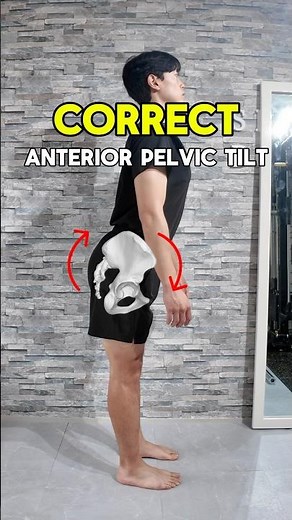 Finally FIx Your Anterior Pelvic Tilt