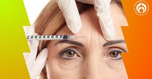 ¿A qué edad se recomienda aplicar bótox en la cara para lucir siempre joven?