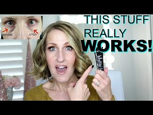 HOW TO GET RID OF EYE BAGS PUFFINESS AND LINES WITHOUT...