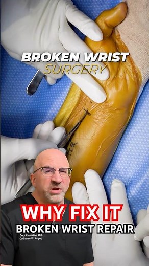 When Should Broken Wrist Be Fixed 🛠️ #shorts