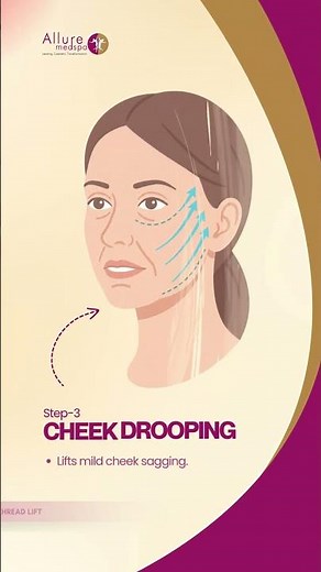 Thread Lift Explained: Who Benefits the Most?