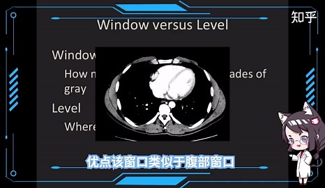 CT图像调窗是什么
