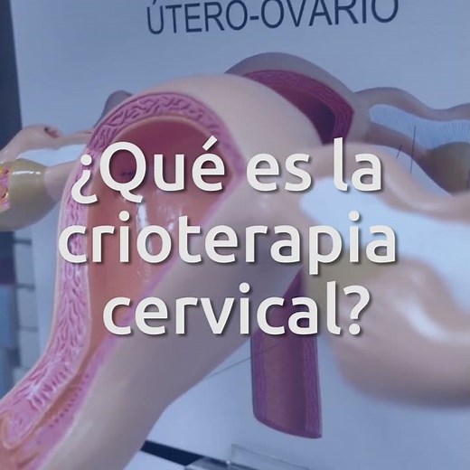 Crioterapia cervical: Tratamiento de lesiones en el cuello uterino con nitrógeno líquido